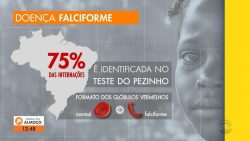 mais-frequente-entre-a-populacao-negra,-doenca-falciforme-causa-dores-intensas;-associacao-busca-pacientes-no-rs